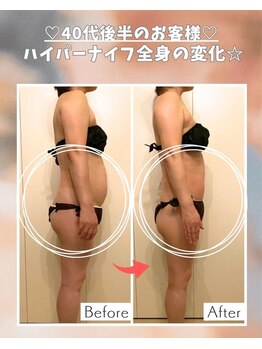 エステサロン 凛/年とともにお腹周りが。。。