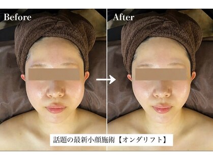 リフト 下北沢(Lift)の写真
