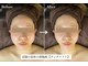 リフト 下北沢(Lift)の写真
