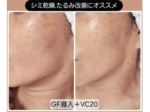 シェリングの雰囲気（【美容皮膚科監修】GF細胞活性フェイシャルで若々しく.ハリ.弾力）