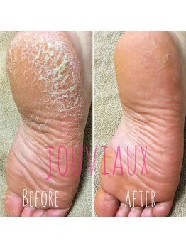 ジョビオ 足利サロン(JOUVIAUX)/フットケア