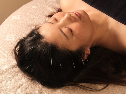 チョウノヤシロの写真