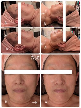 ビューティーサロン ラ ルーチェ(beauty salon La Luce)/30分後の衝撃の変化☆