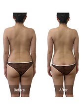 ベンザイ 梅田店(BENZAI)/リラクゼーション、メンテナンス