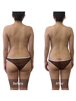 ベンザイ 梅田店(BENZAI)/リラクゼーション、メンテナンス