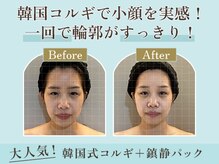 むくみを流して、スッキリ小顔へ導きます。