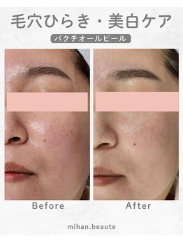 ミハン ボーテ(mihan.beaute)/