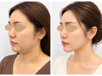 ドクターマジックタッチ(Dr.MAGIC TOUCH)の写真/「いつの間にこんなに？」頬のお肉の厚み・たるみ・二重あご。「私の顔は変わらない」を覆す最上級小顔術
