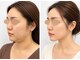 ドクターマジックタッチ(Dr.MAGIC TOUCH)の写真/「いつの間にこんなに？」頬のお肉の厚み・たるみ・二重あご。「私の顔は変わらない」を覆す最上級小顔術
