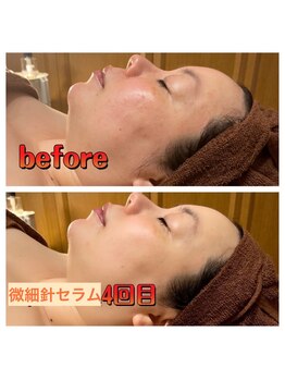 ヌーベルコピーヌ/何歳からでも変われます！！