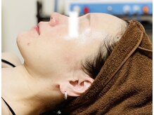 メディカルサロン かとれあ/お客様のお肌