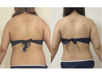 プリマルーチェ/プレミアム花嫁様プログラム