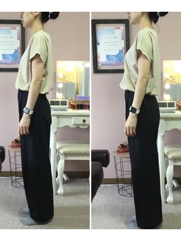 スマイル(smile)/before after 