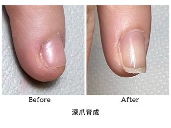 アンベリール(embellir.)/深爪育成