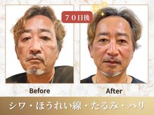 ビーシャルム(b.ChaRme)/b.ChaRme独自のフェイシャルケア