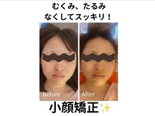 スターリィ スカイ(Starry☆Sky)/【小顔矯正】