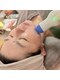 リラクゼーションラボ ユニコ(unico)の写真/県内希少ショット型RF「サーマティノア」で気になる年齢肌のお悩みにアプローチ！内側から美肌へ☆