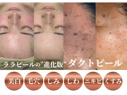 骨盤ダイエットサロン カンフリエ(camphrier)の写真