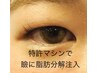 『はれぼったい瞼】or【眼瞼が下垂した方】or【目の下のシワ】目元の悩み改善