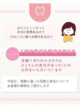 エクシアホワイトニング 阪急洛西口駅前店/歯科衛生士が解説