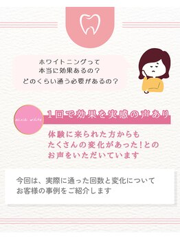 エクシアホワイトニング 阪急洛西口駅前店/歯科衛生士が解説