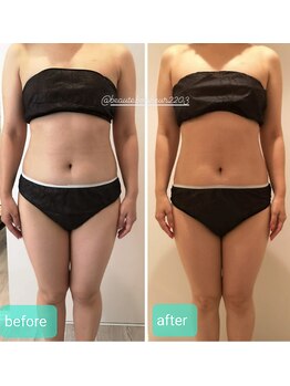 ボーテボナー(Beaute Bonheur)/♪痩身ボディ♪