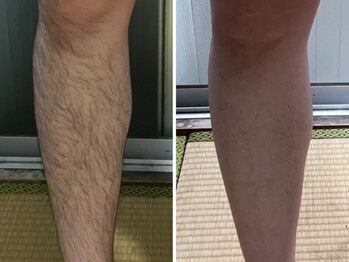 セラヴィオキナワ(Cellavi okinawa)/シュガーリングWAX