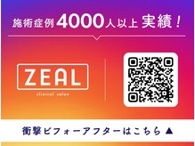 ジール(ZEAL)の雰囲気（白を基調とした明るい店内でお過ごし下さい♪）