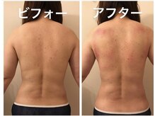 ステージ(Stage)/上半身痩身