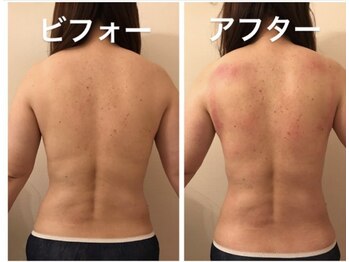 ステージ(Stage)/上半身痩身