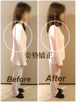 ティーエスエル とがし整体ラボ(TSL とがし整体 Labo)/ブライダル整体/骨盤矯正/反り腰