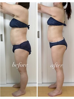 バニスティ 鶴岡店/全身リンパでお腹周りもスッキリ