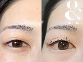 アフェプラス トータルビューティーサロン 香里園店(affe+ total beauty salon)/エクパ(アンドヘルシー)LED80本