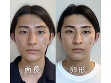 ナビレラ(navillera)の雰囲気（小顔矯正とアイブロウのセットでメンズもキリッと印象変化◎）