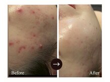 マルサンカクシカク(○△□)/