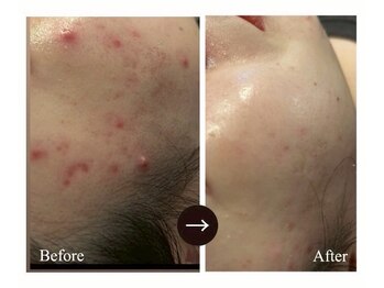 マルサンカクシカク(○△□)/