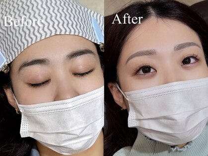 エニング(ening)の写真