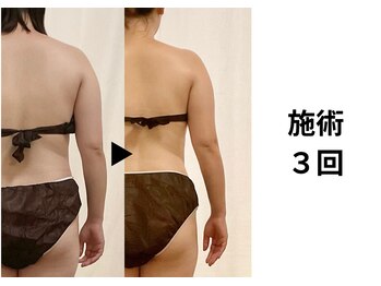 ディアメデル(Diamedel)/