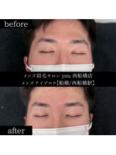 ユー 西船橋店(you)/ビフォーアフターお写真