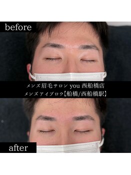 ユー 西船橋店(you)/ビフォーアフターお写真
