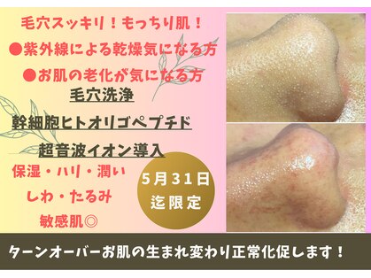 ビービー(BB)の写真