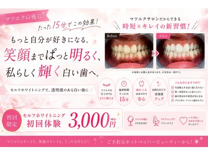 アイネ(eye:ne)の写真