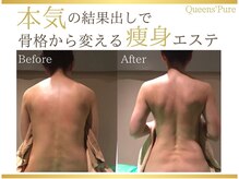 クイーンズ ピュア 長崎店(Queen's Pure)の雰囲気(痩身マシン&最強揉みだしリンパで夏まで間に合う美ボディへ!!)