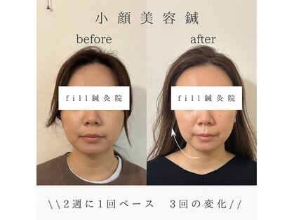 フィル(fill)の写真