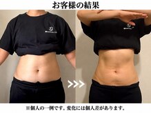 ベラ