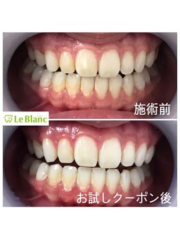 ルブラン 奈良店(Le Blanc)/学生様にもリーズナブル!