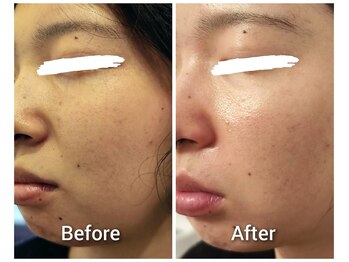 トータルボディケアアンドビューティー タイヨウ(TOTAL BODY CARE&BEAUTY TAIYO)/<フェイシャルエステ>