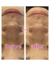 リジュベ(Rejuve)/船橋エステ/ブライダル/メンズ