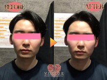 ヴィオーデ 船橋店/小顔、リンパ、ヘッドスパ、整体