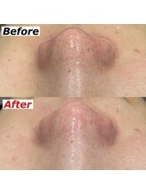 ビーブルーセブン(B.BLUE7)/【最新ハイドロヴィーナススパ】